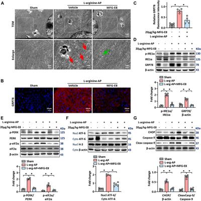 Corrigendum: MFG-E8 maintains cellular homeostasis by suppressing endoplasmic reticulum stress in pancreatic exocrine acinar cells